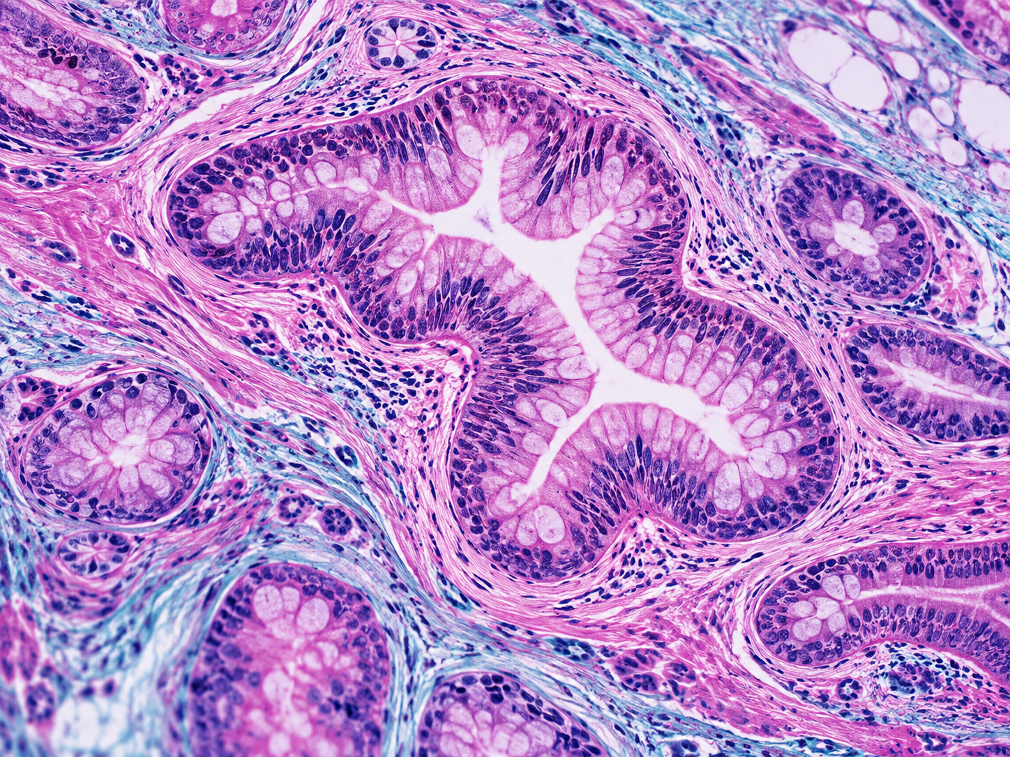 Imagen microscópica de tejido teñido